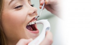 Dental Prophylaxis (Cleaning)