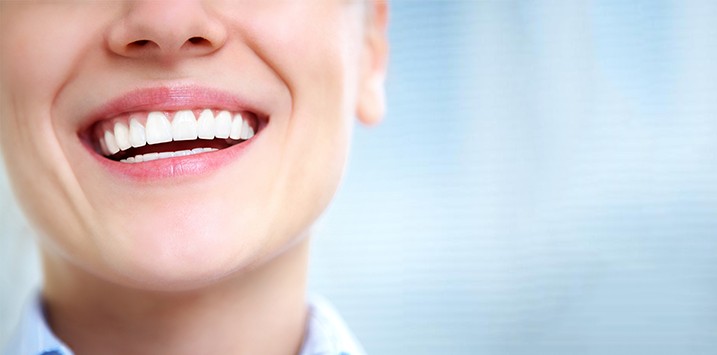 Porcelain Veneers - Are they worth it?