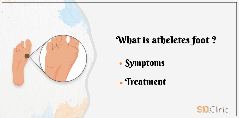 What is atheletes foot ?