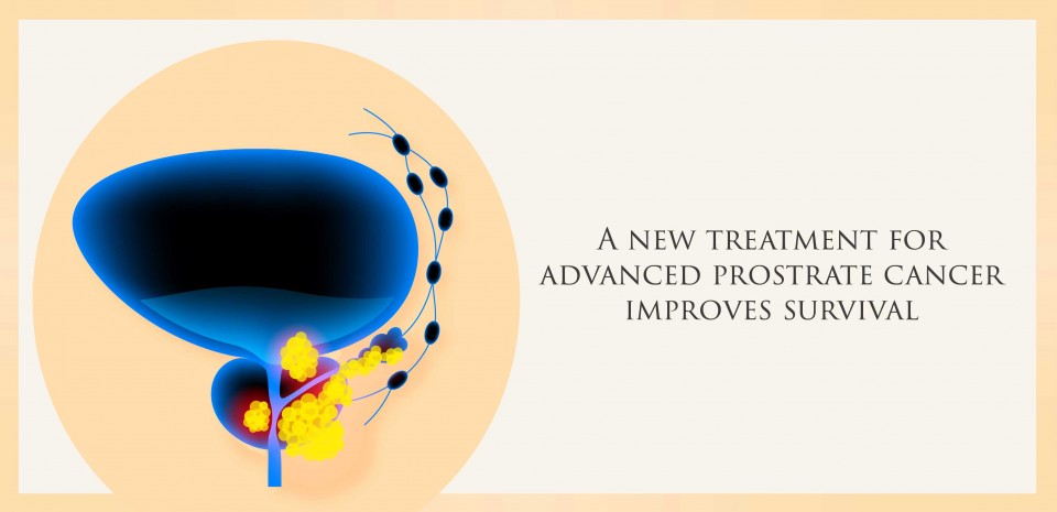 A new treatment for advanced prostate cancer improves survival