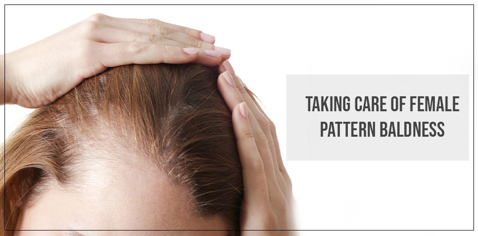 Taking care of Female Pattern Baldness