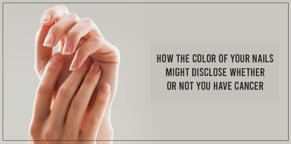 How the color of your nails might disclose whether or not you have cancer