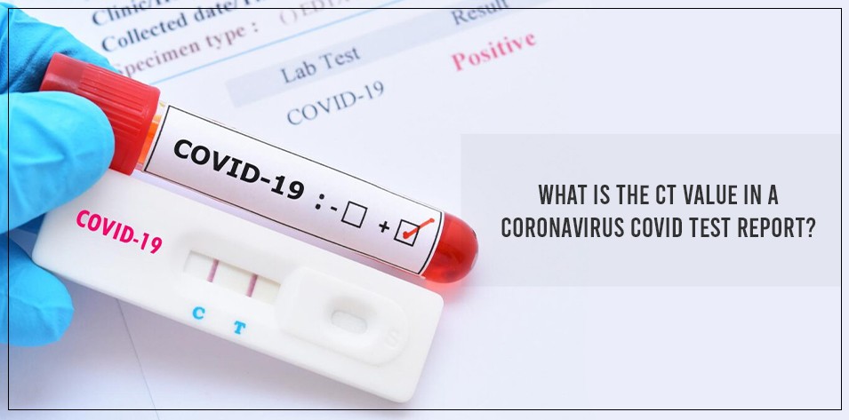 What is the Ct value in a Coronavirus COVID test report?