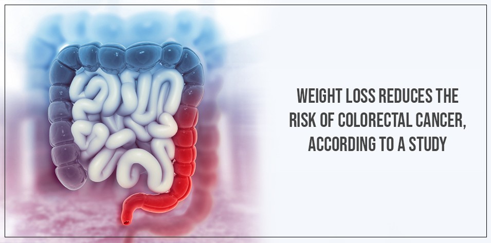 Weight loss reduces the risk of colorectal cancer, according to a study