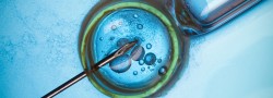 Intracytoplasmic Sperm Injection